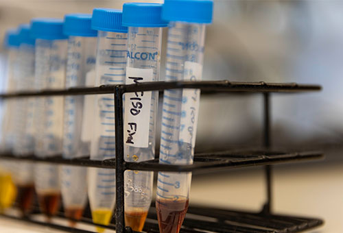 Iron oxide nanoparticles of different concentrations. The light and dark colors represent low and high concentrations.