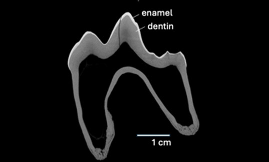 Tooth scan displaying crack