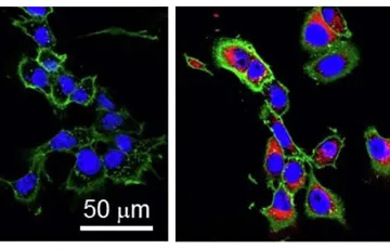 cancer cells under a microscope