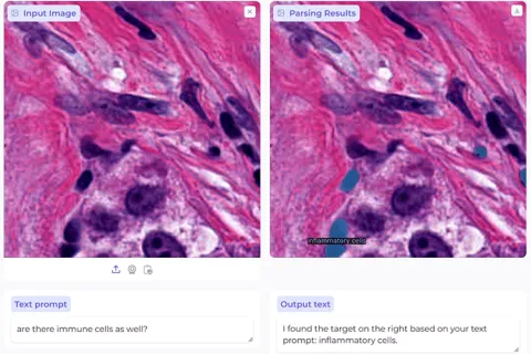 AI medical image analysis model